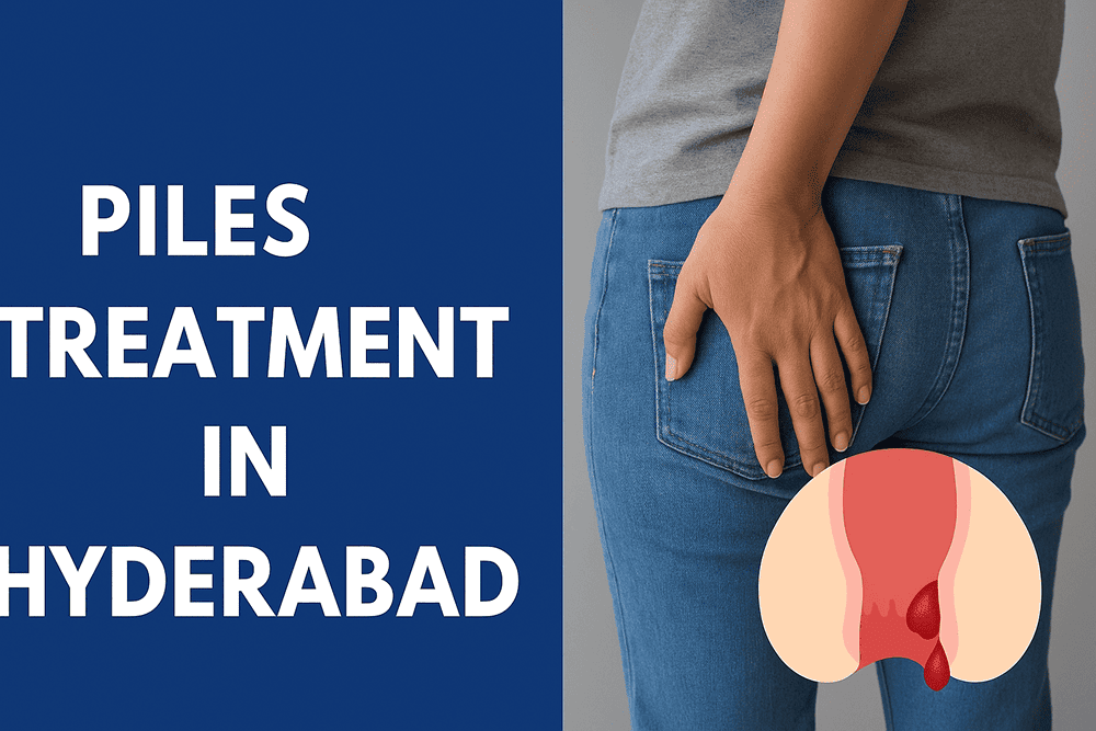 Piles Treatment in Hyderabad: Advanced Care for Quick Relief and Lasting Comfort
